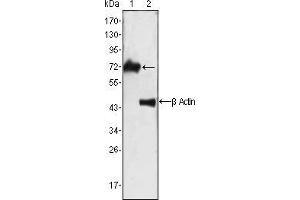Western blot analysis using ZAP70 mouse mAb against Jurkat cell lysate (1).