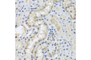 Immunohistochemistry of paraffin-embedded mouse kidney using CETN3 antibody (ABIN5974786) at dilution of 1/100 (40x lens). (CETN3 抗体)