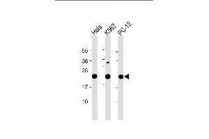 All lanes : Anti-LZIC Antibody (Center) at 1:2000 dilution Lane 1: Hela whole cell lysate Lane 2: K562 whole cell lysate Lane 3: PC-12 whole cell lysate Lysates/proteins at 20 μg per lane. (LZIC 抗体  (AA 81-109))