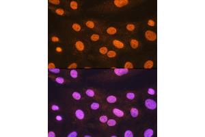 Immunofluorescence analysis of H9C2 cells using POLR2A Rabbit pAb (ABIN3022932, ABIN3022933, ABIN3022934 and ABIN6219303) at dilution of 1:100. (POLR2A/RPB1 抗体  (AA 1-260))