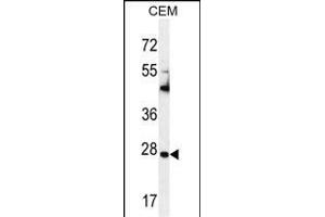 TI Antibody (C-term) (ABIN655149 and ABIN2844770) western blot analysis in CEM cell line lysates (35 μg/lane). (TIMP1 抗体  (C-Term))