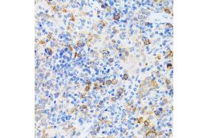 Immunohistochemistry of paraffin-embedded mouse spleen using p60 C antibody  at dilution of 1:100 (40x lens).