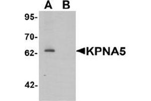 Western blot analysis of KPNA6 in EL4 cell lysate with KPNA5 Antibody  at 1 μg/mL in (A) the absence and (B) the presence of blocking peptide. (KPNA5 抗体  (N-Term))