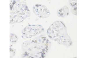 Immunohistochemistry of paraffin-embedded Human placenta using CREM Polyclonal Antibody at dilution of 1:100 (40x lens). (CREM 抗体)