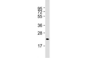 Western blot testing of human skeletal muscle lysate with Irisin antibody at 1:2000. (FNDC5 抗体  (AA 12-152))