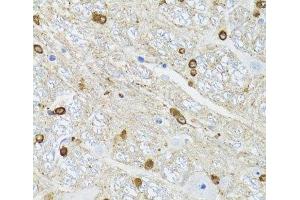 Immunohistochemistry of paraffin-embedded Mouse brain using TPPP Polyclonal Antibody at dilution of 1:100 (40x lens). (Tppp 抗体)