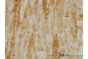 Immunoperoxidase of monoclonal antibody to CFL2 on formalin-fixed paraffin-embedded human skeletal muscle. (Cofilin 2 抗体  (AA 57-166))