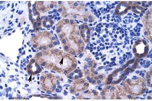 Human kidney; ZNF84 antibody - C-terminal region in Human kidney cells using Immunohistochemistry (ZNF84 抗体  (C-Term))