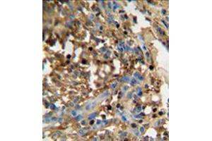 Immunohistochemistry (Paraffin-embedded Sections) (IHC (p)) image for anti-Family with Sequence Similarity 20, Member C (FAM20C) (AA 443-471), (C-Term) antibody (ABIN951886)