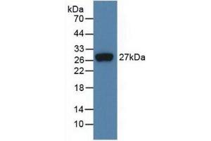 Detection of Recombinant FGF21, Human using Monoclonal Antibody to Fibroblast Growth Factor 21 (FGF21) (FGF21 抗体  (AA 29-209))