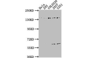 Western Blot Positive WB detected in: Hela whole cell lysate, 293 whole cell lysate, COLO320 whole cell lysate, 293T whole cell lysate, U251 whole cell lysate All lanes: ERC1 antibody at 1:2000 Secondary Goat polyclonal to rabbit IgG at 1/50000 dilution Predicted band size: 129, 114, 125, 109, 82 kDa Observed band size: 135 kDa (ERC1 抗体  (AA 1-224))