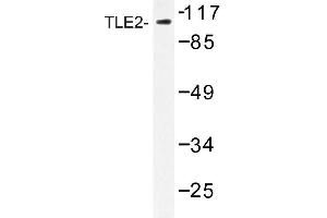 Image no. 1 for anti-Transducin-Like Enhancer Protein 2 (TLE2) antibody (ABIN272212) (TLE2 抗体)