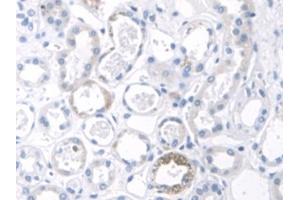 Immunohistochemistry (IHC) image for anti-Keratin 2 (KRT2) (AA 7-160) antibody (ABIN7431878)