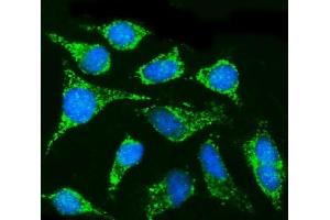 IF analysis of CPT1B using anti-CPT1B antibody (ABIN7600359). (CPT1B 抗体  (AA 180-772))