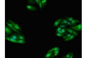 Immunofluorescent analysis of HepG2 cells using ABIN7171602 at dilution of 1:100 and Alexa Fluor 488-congugated AffiniPure Goat Anti-Rabbit IgG(H+L) (TBC1D15 抗体  (AA 283-404))