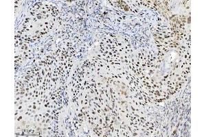 IHC analysis of MCM7 using anti-MCM7 antibody (ABIN7601968). (MCM7 抗体  (AA 526-719))