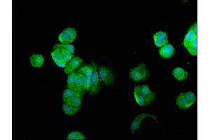 Immunofluorescence staining of MCF-7 cells with ABIN7157790 at 1:100, counter-stained with DAPI. (FUK 抗体  (AA 579-758))