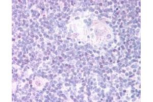 FOXN1 polyclonal antibody  staining (20 ug/mL) of paraffin embedded human thymus medulla. (FOXN1 抗体)