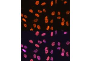 Immunofluorescence analysis of C6 cells using KHDRBS1/KHDRBS1/Sam68 Rabbit mAb (ABIN1680037, ABIN3018237, ABIN3018238 and ABIN7101585) at dilution of 1:100 (40x lens).