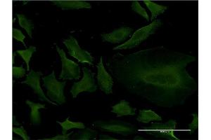 Immunofluorescence of monoclonal antibody to CYP1A2 on HeLa cell. (CYP1A2 抗体  (AA 211-310))
