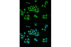 Immunofluorescence analysis of HeLa cells using UPF1 antibody. (RENT1/UPF1 抗体  (AA 270-370))