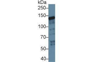 Western Blot; Sample: Human K562 cell lysate; Primary Ab: 1µg/ml Rabbit Anti-Rat XPC Antibody Second Ab: 0. (XPC 抗体  (AA 734-933))