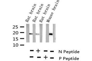 Western blot analysis of Phospho-Synuclein (Ser129) expression in various lysates (SNCA 抗体  (pSer129))