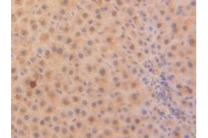 DAB staining on IHC-P; Samples: Rat Liver Tissue