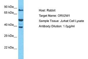 Western Blotting (WB) image for anti-Olfactory Receptor, Family 52, Subfamily W, Member 1 (OR52W1) (C-Term) antibody (ABIN2791837)