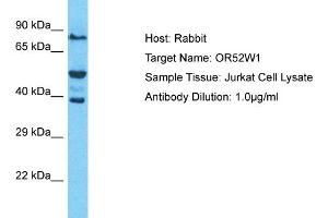 Host: Rabbit Target Name: OR52W1 Sample Type: Jurkat Whole Cell lysates Antibody Dilution: 1. (OR52W1 抗体  (C-Term))