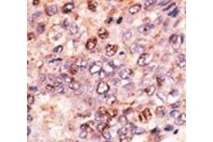 Immunohistochemistry (IHC) image for anti-ATP-Binding Cassette, Sub-Family B (MDR/TAP), Member 7 (ABCB7) (AA 718-746) antibody (ABIN3030053)