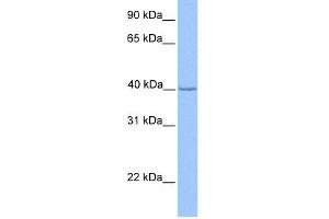 WB Suggested Anti-ZNF385D Antibody Titration:  0.