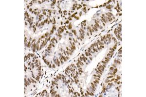 Immunohistochemistry (IHC) image for anti-DEAD (Asp-Glu-Ala-Asp) Box Polypeptide 3, X-Linked (DDX3X) (AA 1-220) antibody (ABIN6139494)
