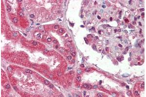 Human Kidney (formalin-fixed, paraffin-embedded) stained with Collagen I antibody ABIN462339 followed by biotinylated goat anti-rabbit IgG secondary antibody ABIN481713, alkaline phosphatase-streptavidin and chromogen. (Collagen Type I 抗体)