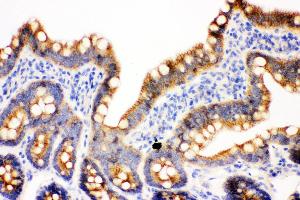 Anti- gamma Catenin Picoband antibody, IHC(P) IHC(P): Rat Intestine Tissue (JUP 抗体  (AA 556-745))