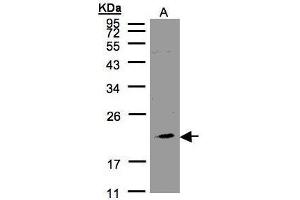 WB Image Sample(30 μg of whole cell lysate) A:293T 12% SDS PAGE antibody diluted at 1:1000 (KLRC4 抗体  (N-Term))