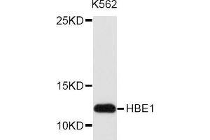 Western blot analysis of extracts of K562 cell line, using HBE1 antibody. (Hemoglobin, epsilon 1 (HBe1) 抗体)