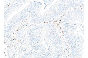 Immunohistochemistry (IHC) image for anti-CD14 (CD14) (AA 20-352) antibody (ABIN7453998) (Recombinant CD14 抗体  (AA 20-352))