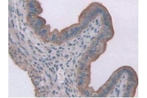 IHC-P analysis of Mouse Uterus Tissue, with DAB staining. (Leptin Receptor 抗体  (AA 22-203))