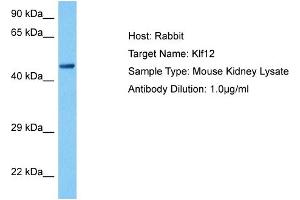 Western Blotting (WB) image for anti-Kruppel-Like Factor 4 (Gut) (KLF4) (C-Term) antibody (ABIN2780577)