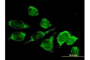 Immunofluorescence of purified MaxPab antibody to DLAT on HeLa cell. (DLAT 抗体  (AA 1-647))