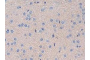 Detection of IL35 in Mouse Cerebrum Tissue using Polyclonal Antibody to Interleukin 35 (IL35) (Interleukin 35 抗体  (AA 23-215))