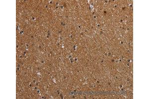 Immunohistochemistry of Human brain  using MT-ND1 Polyclonal Antibody at dilution of 1:50