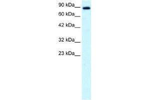 WB Suggested Anti-KIF21A Antibody Titration:  0. (KIF21A 抗体  (N-Term))