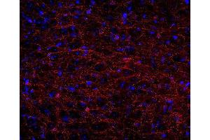 Indirect immunostaining of PFA fixed rat brain section (dilution 1 : 500; red). (Cnpase 抗体)