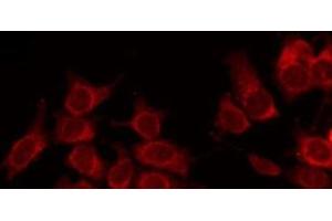 ABIN6266839 staining NIH-3T3 by IF/ICC. (alpha Tubulin 抗体)