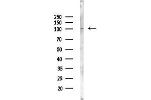 anti-Protein Kinase N1 (PKN1) (Internal Region) antibody