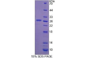 SDS-PAGE analysis of Rat SSA1 Protein. (TRIM21 蛋白)