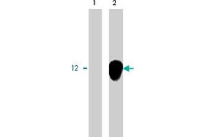 Immunoprecipitation using DAP12 polyclonal antibody on MHC class I (1) and NKp44 (2) positive cells.