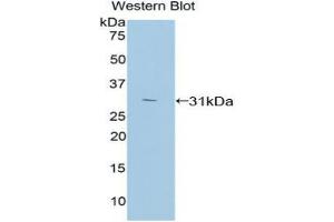 Western blot analysis of the recombinant protein. (PKC zeta 抗体  (AA 254-484))